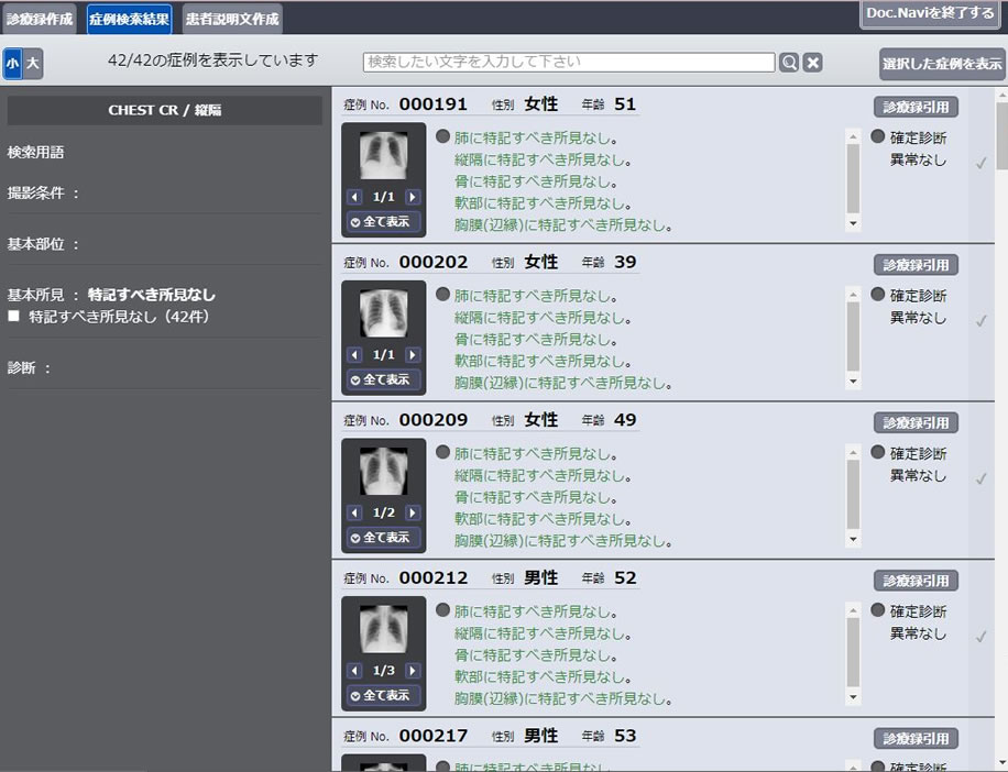 画像診断ナビゲーター Doc.navi 正常症例検索