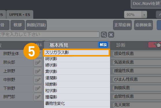画像診断ナビゲーター Doc.navi 所見解説