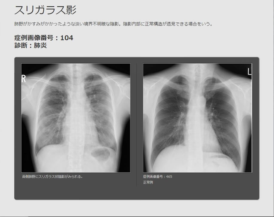 画像診断ナビゲーター Doc.navi 所見解説