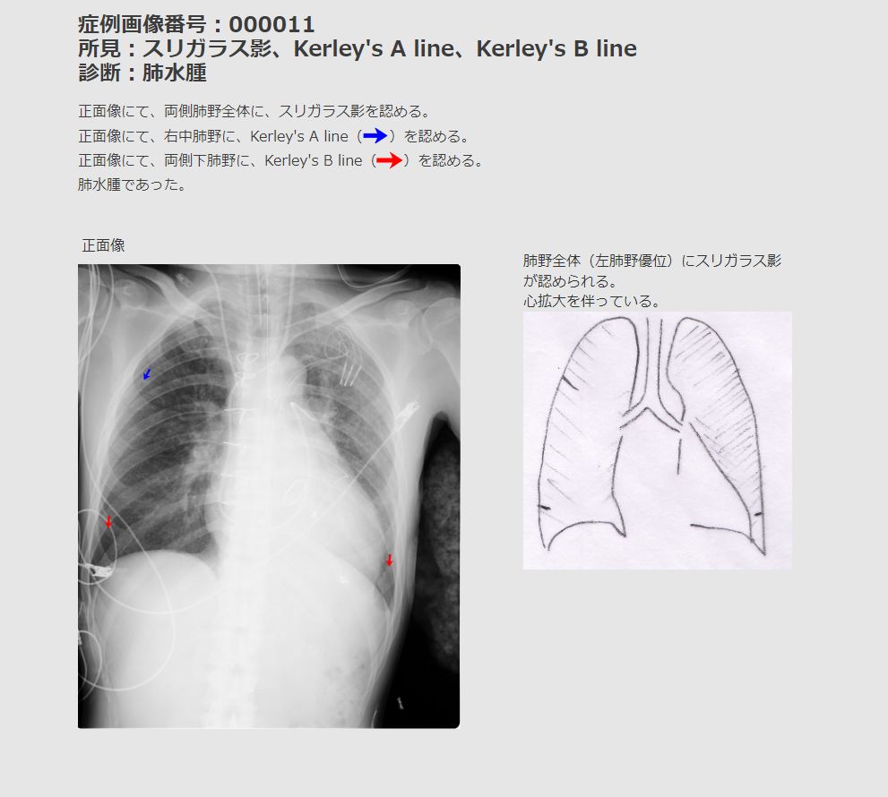 画像診断ナビゲーター Doc.navi 症例解説