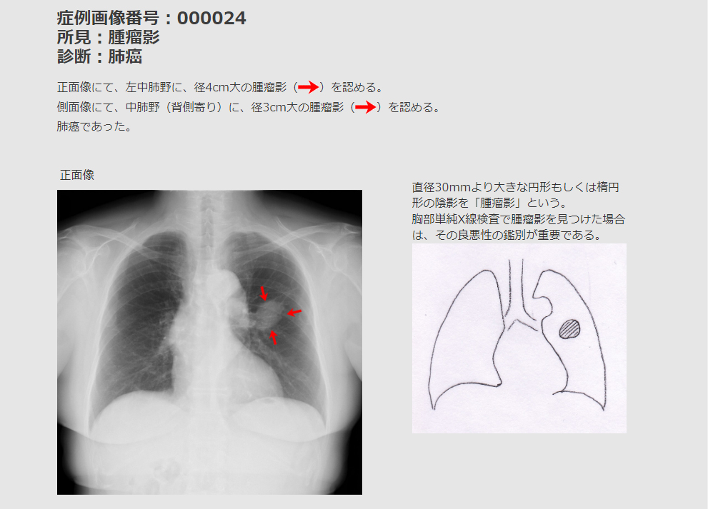 画像診断ナビゲーター Doc.navi