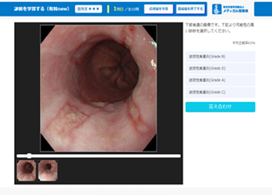 画像診断シミュレーター simu.Doc 上部消化管内視鏡